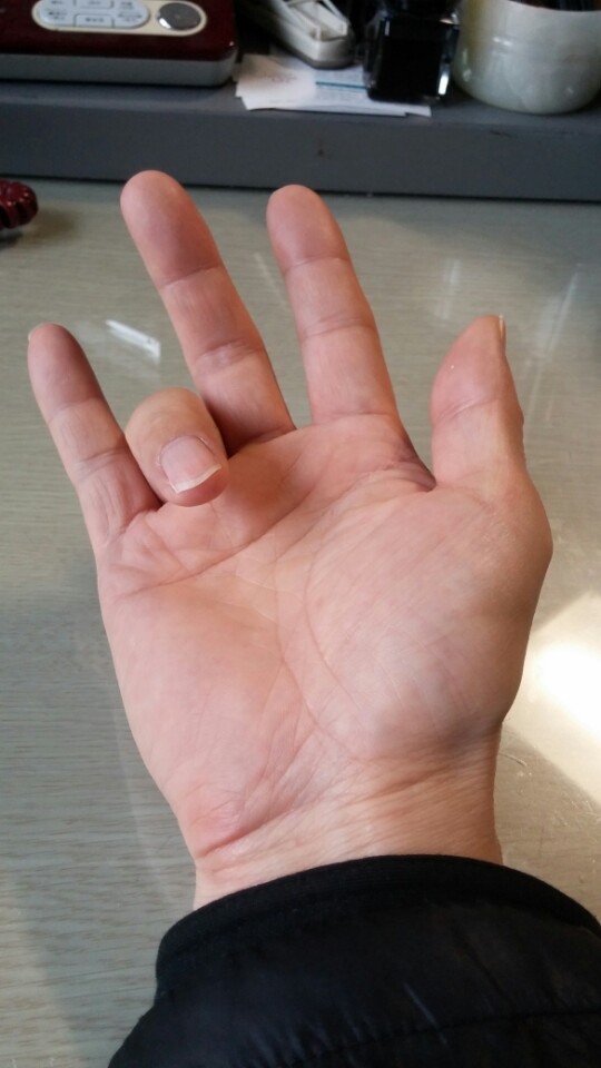 안중근 의사 손.jpg